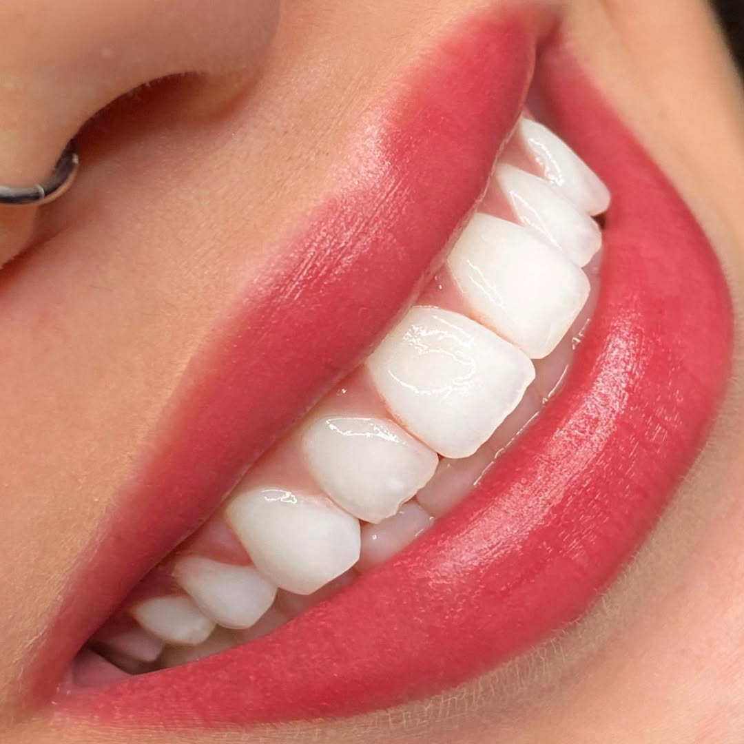 Micropigmentação e nanopigmentação labial